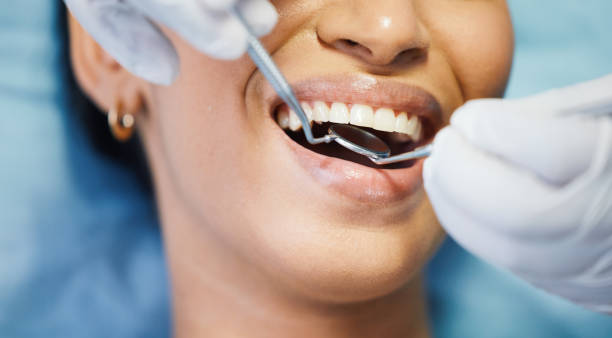Best Emergency Denture Repair in Fenton, MO